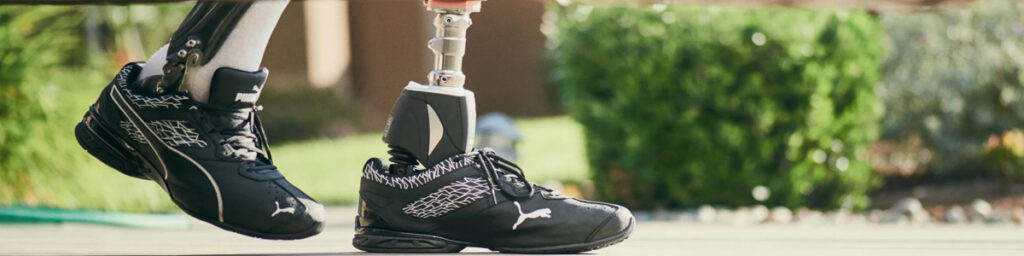 Zbliżenie na nogi osoby po amputacji podczas spaceru: lewa noga zdrowa, prawa z widoczną protezą podudzia i dynamiczną stopą protetyczną w czarnym bucie sportowym Puma.