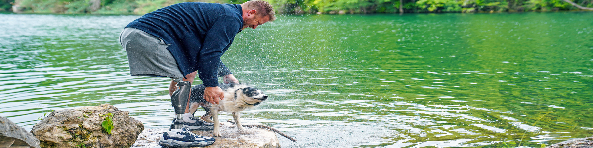 Mężczyzna z protezą podudzia i sportową stopą protetyczną podczas aktywnego wypoczynku nad jeziorem z psem.