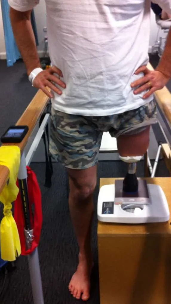 Rehabilitacja — wstępne obciążanie implantu